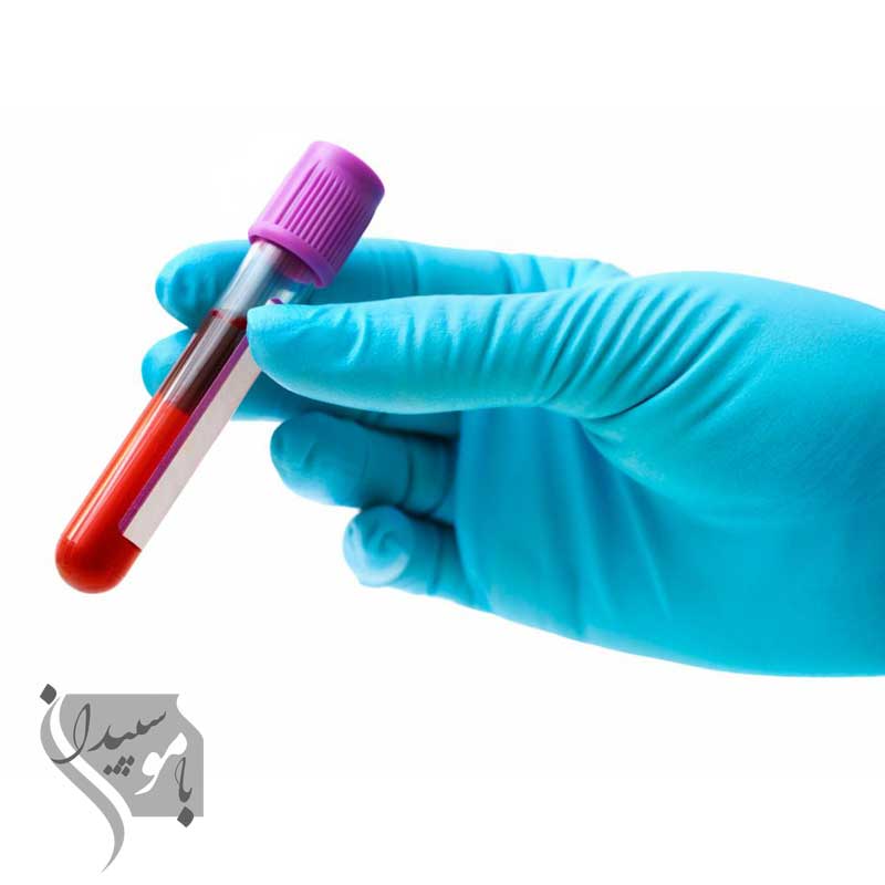 ۱۵ آزمایش ضروری برای سلامت سالمندان