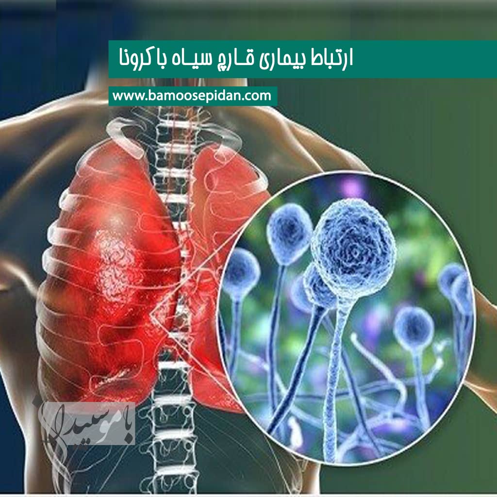 ارتباط بیماری قارچ سیاه با کرونا