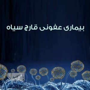 بیماری عفونی قارچ سیاه