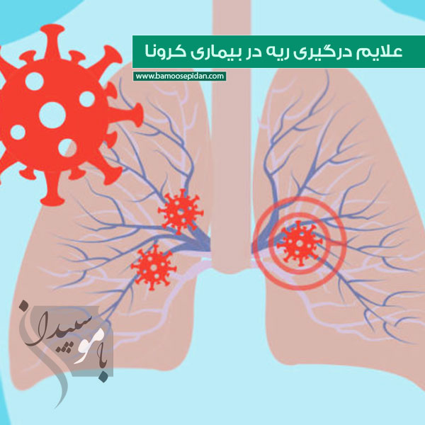 علایم درگیری ریه در بیماری کرونا