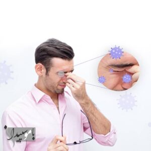 شایع ترین بیماری های چشم