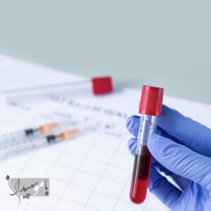 ناشتا بودن پیش از آزمایش خون