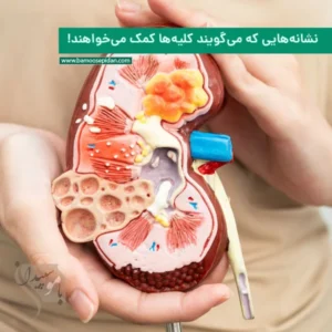 نشانه هایی که می‌گویند کلیه ها کمک می‌خواهند!
