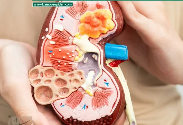 نشانه‌هایی که می‌گویند کلیه ها کمک می‌خواهند!