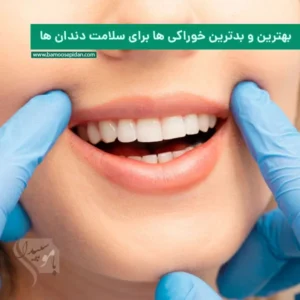 بهترین و بدترین خوراکی ها برای سلامت دندان ها