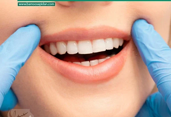 بهترین و بدترین خوراکی ها برای سلامت دندان ها