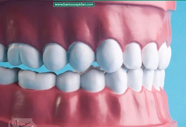 چرا انسان های امروزی 32 دندان دارند؟