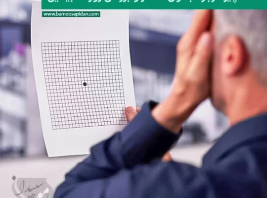 همه چیز درباره جدول آمسلر و بررسی روزانه بینایی در بیماری AMD